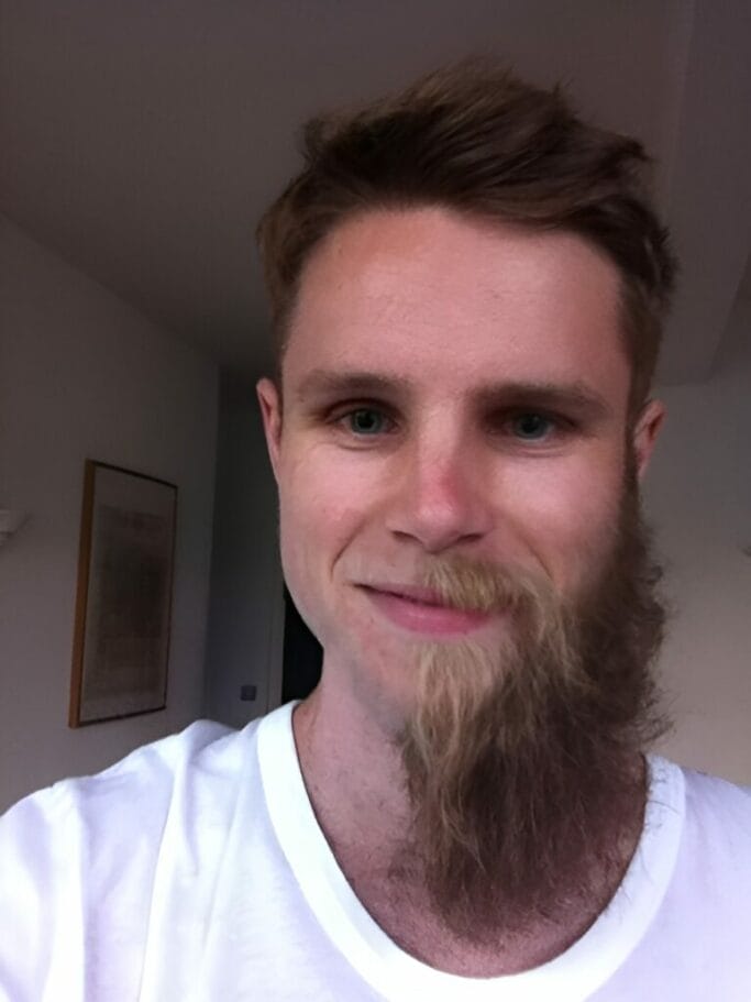 Weird One-Sided Full-Length Beard