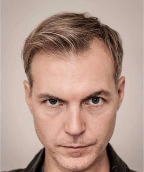 Top Men's Haircuts for Receding Hairlines