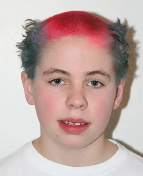 Defying Convention: The Daring World of Reverse Mohawk Hair 21 Red Hot Reverse Mohawk