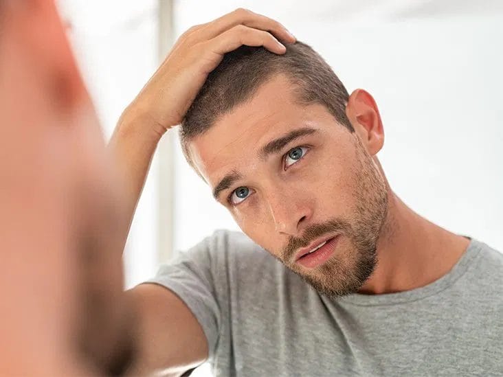 Ultimate Hair Care for Men with Dandruff Guide